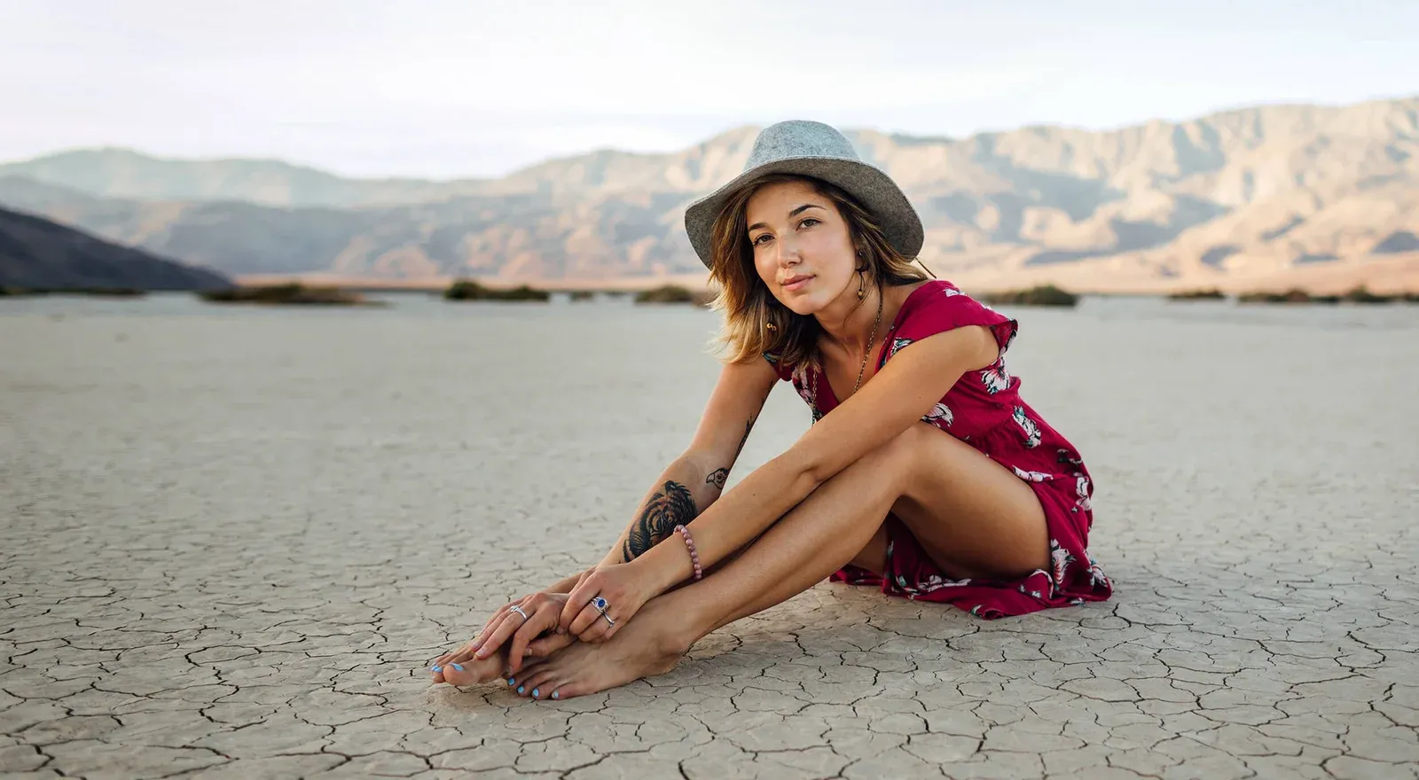 מילוי קמטים